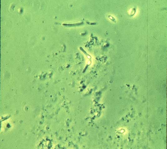 Clostridium botulinum