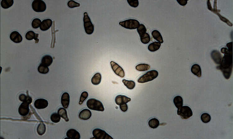 Alternaria alternata under microscope
